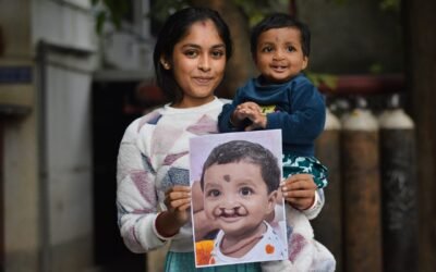 ಕಲಬುರಗಿಯಲ್ಲಿ 100% ಉಚಿತ ಸೀಳು ತುಟಿ ಮತ್ತು ಸೀಳು ಅಂಗುಳ ಚಿಕಿತ್ಸಾ ಕಾರ್ಯಕ್ರಮ | Smile Please