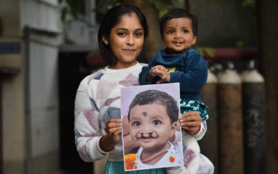 ಕಲಬುರಗಿಯಲ್ಲಿ 100% ಉಚಿತ ಸೀಳು ತುಟಿ ಮತ್ತು ಸೀಳು ಅಂಗುಳ ಚಿಕಿತ್ಸಾ ಕಾರ್ಯಕ್ರಮ | Smile Please
