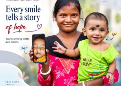Cleft treatment journey at Mission Smile Krishnanagar Cleft Care Center