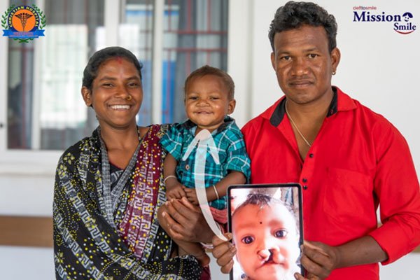 Cleft treatment journey at Mission Smile Krishnanagar Cleft Care Center